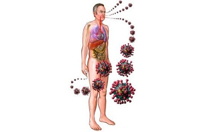 Сколько дней заразен человек с пневмонией. Пневмония заразна?